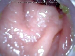 Silit endoscope part 1, free enema punishment dhuwur definisi reged video 04