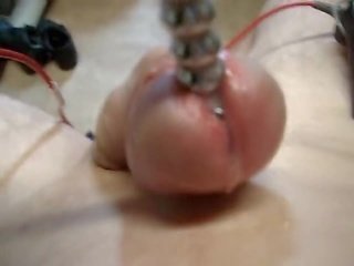 Electro ejaculações estimulação ejac electrotes sounding pica-pau e cu